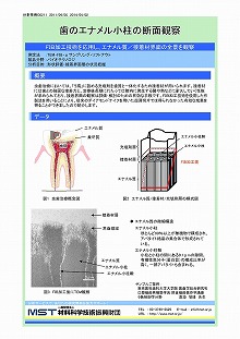 歯のエナメル小柱の断面観察