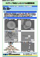 ネガティブ染色による(S)TEM観察事例