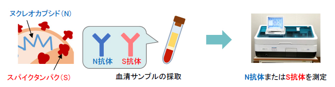 抗体検査をしている自動免疫分析装置コバスe411+