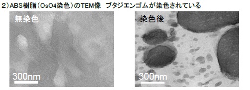 電子染色を用いた高分子材料の(S)TEM観察