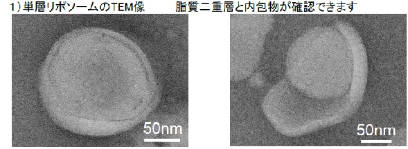 ネガティブ染色による(S)TEM観察事例