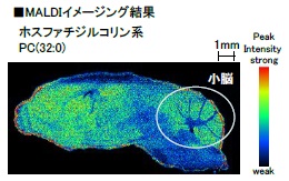 MALDIイメージング結果