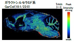 マウス脳の脂質イメージング